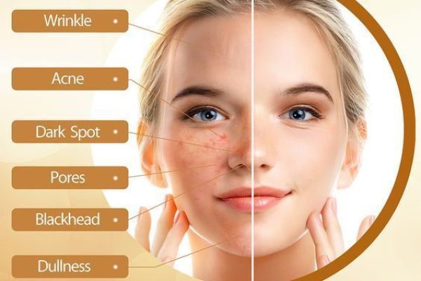 828a97c17b40986a75948feed35c7015